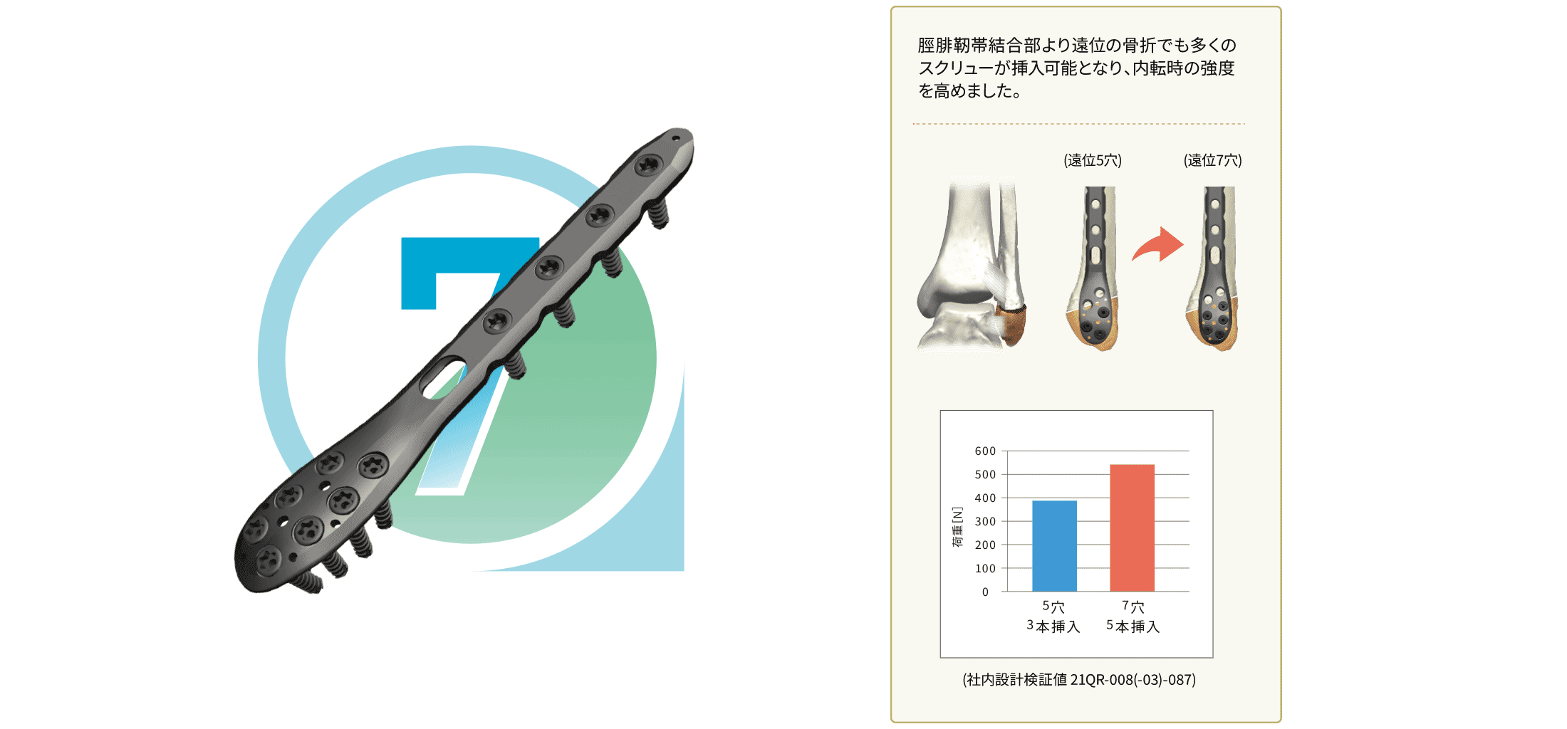 腓骨遠位端「外側」ロッキングプレート（遠位7穴）