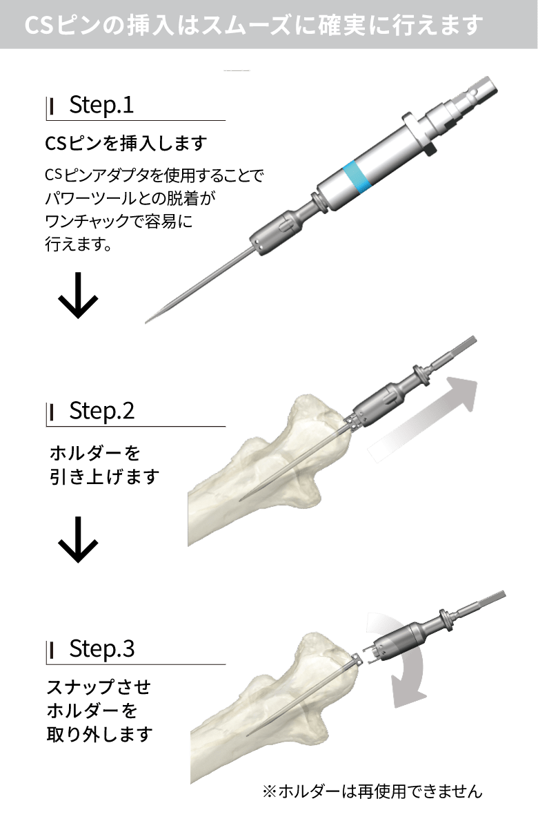 CSPワイヤリングシステム［SUS/Ti］