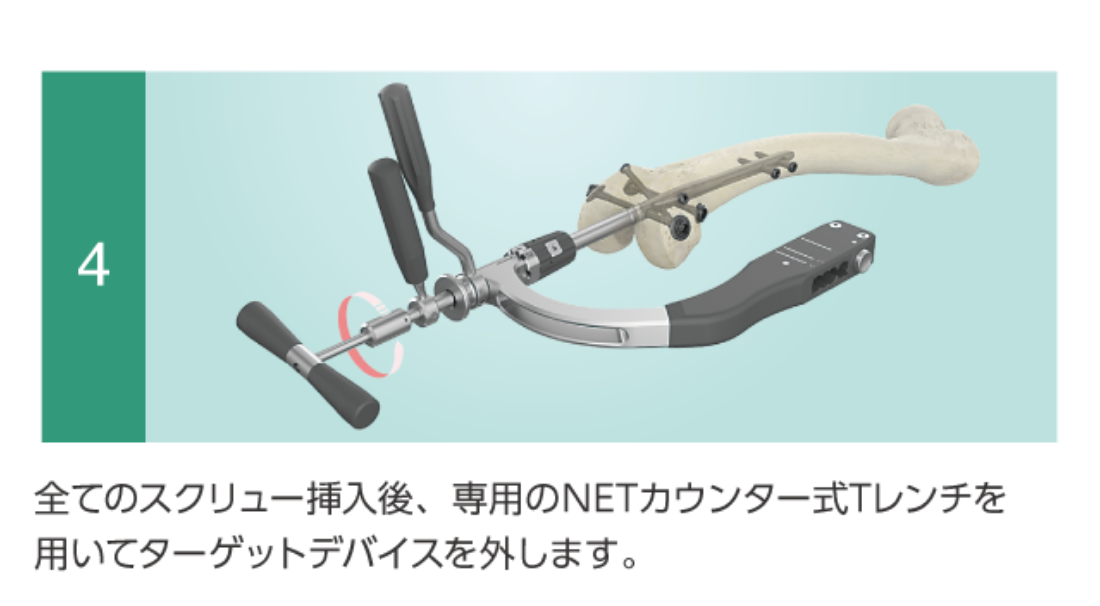N.E.T System  Operation4