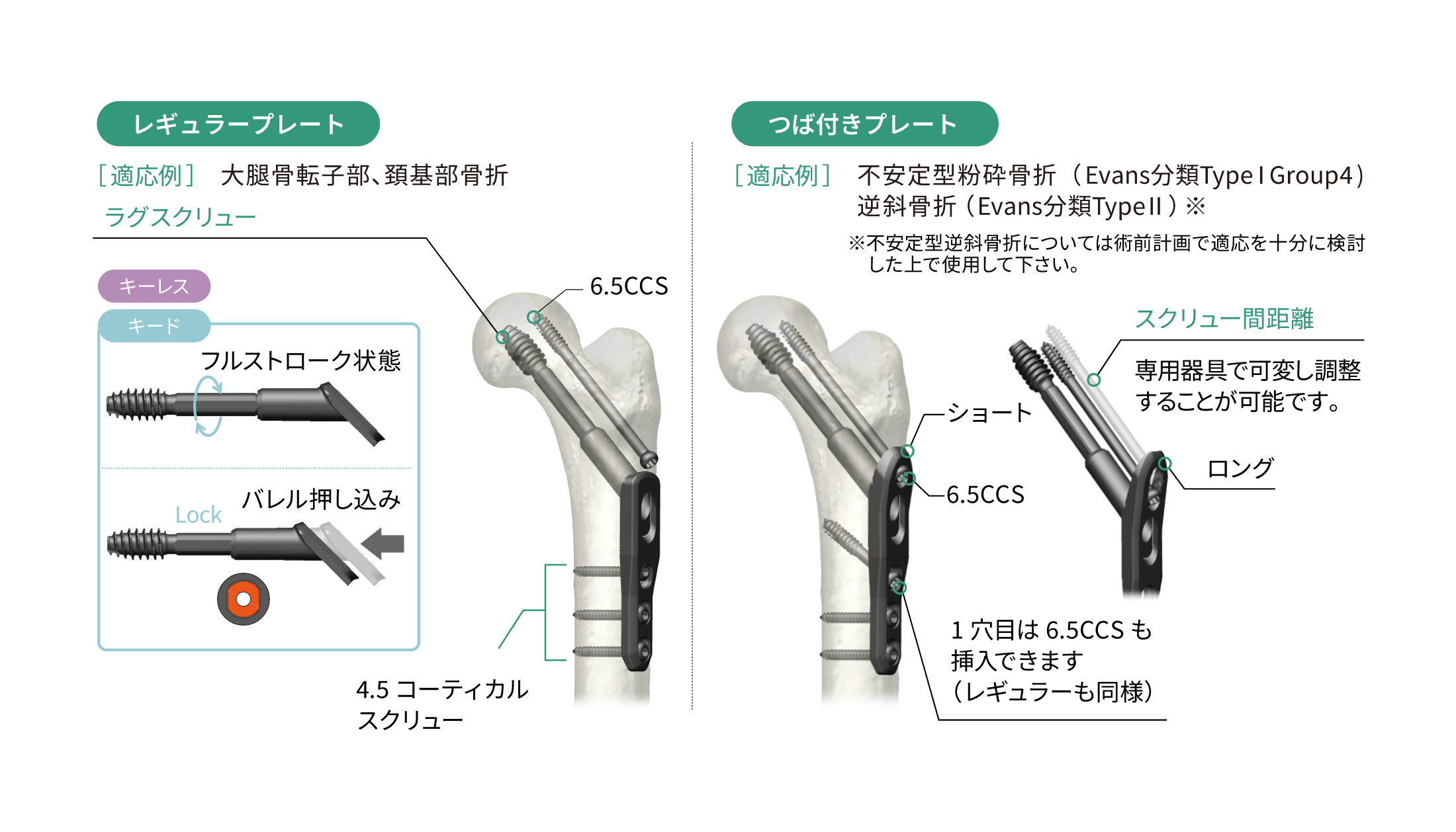 HAI CHS Compression Hip Screw System