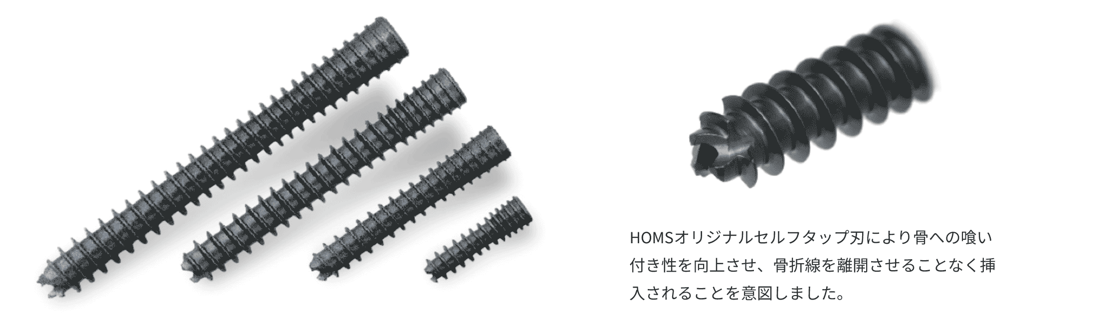 SCS Self Compression Screw