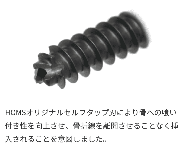 SCS Self Compression Screw