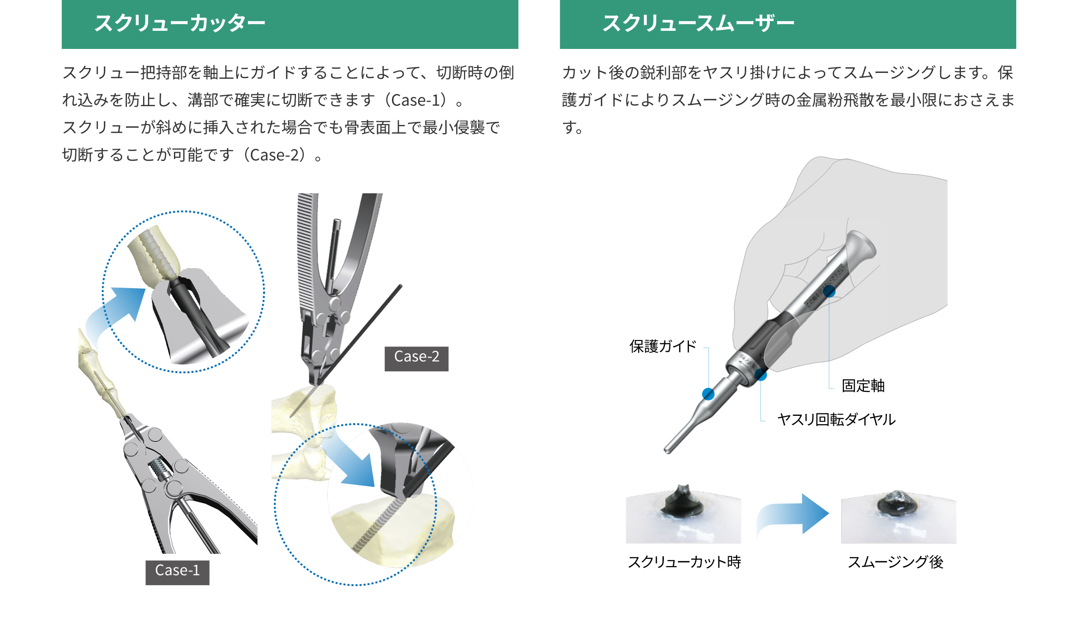 SCS Self Compression Screw