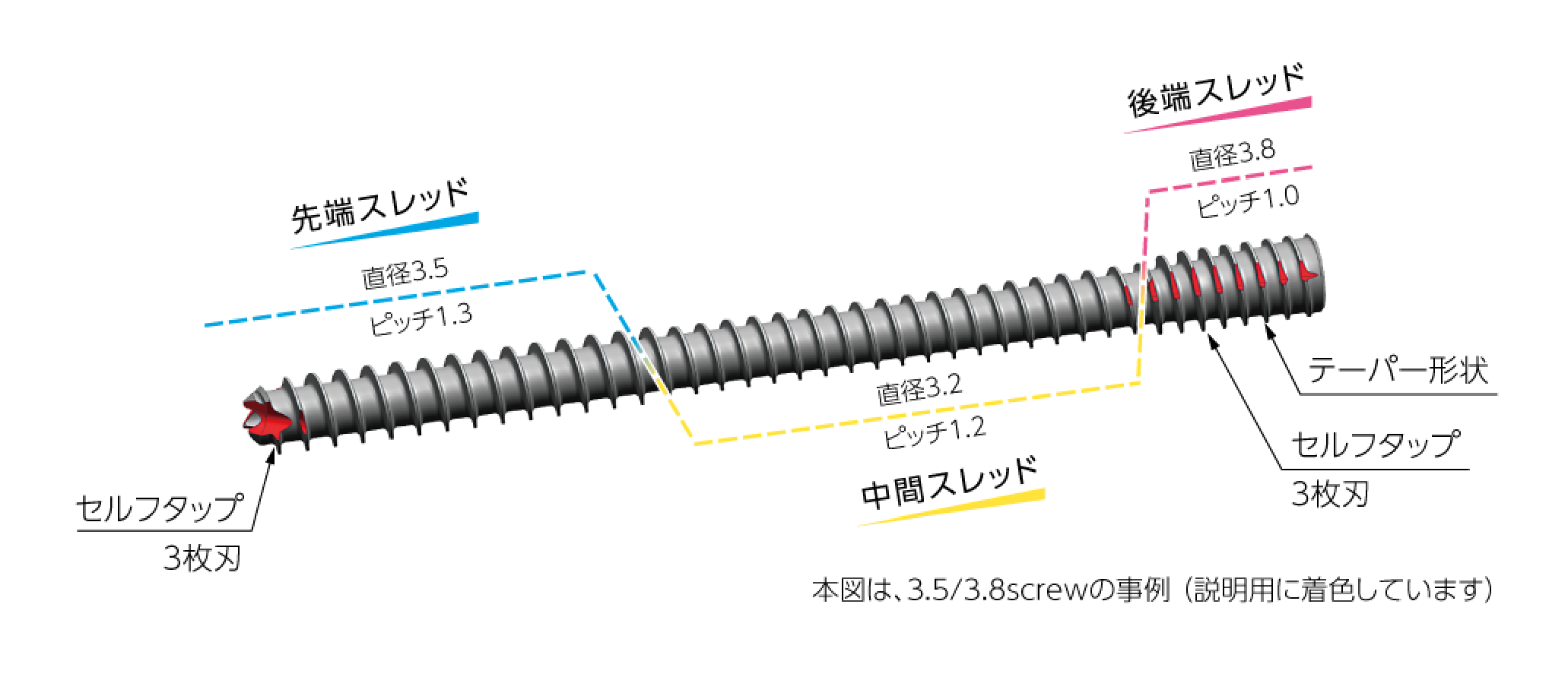 SCS Self Compression Screw