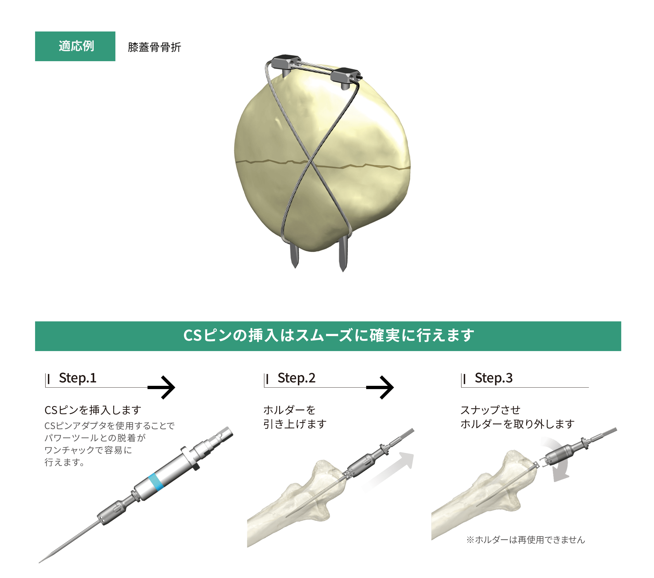 CSPワイヤリングシステム［SUS/Ti］