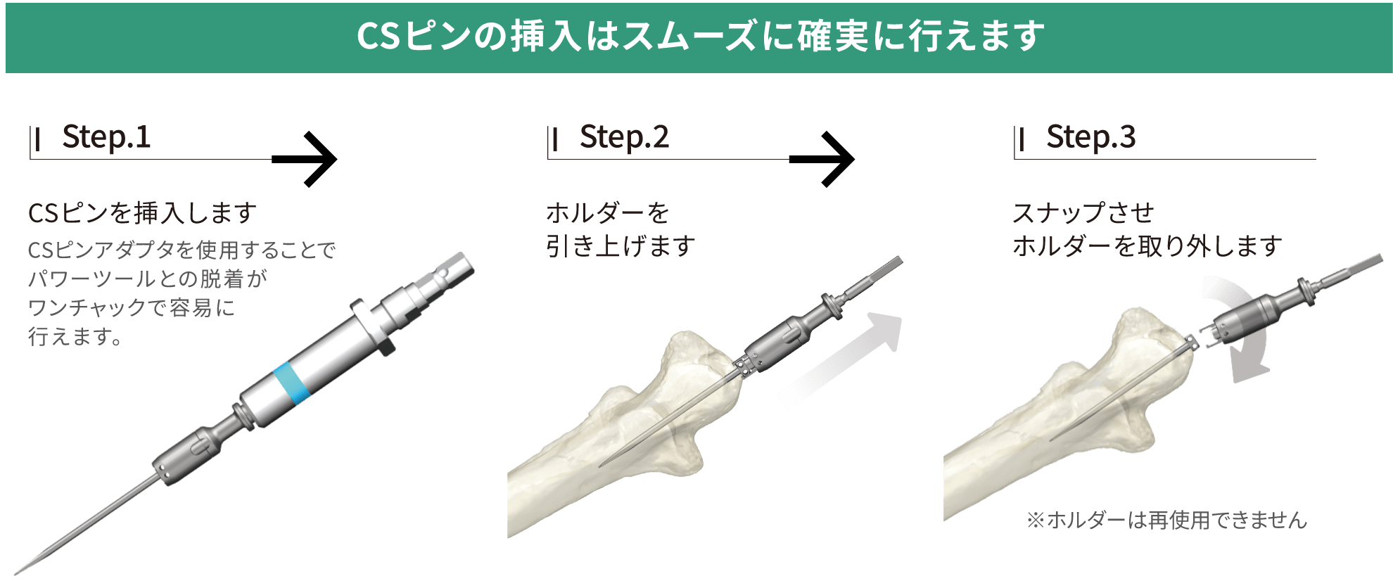 CSPワイヤリングシステム［SUS/Ti］