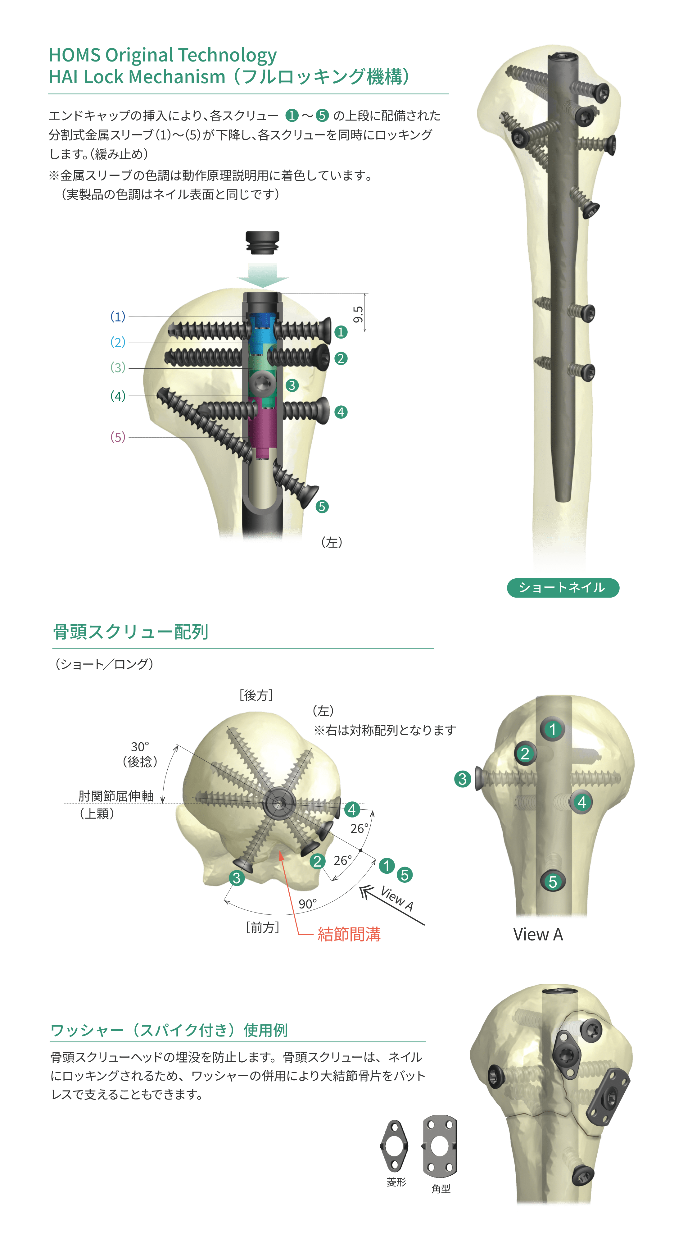 HAI上腕ネイルシステム