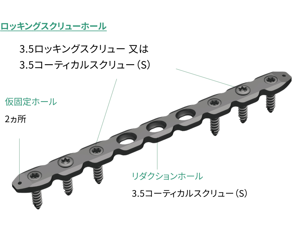 HAIリコンストラクションロッキングプレート