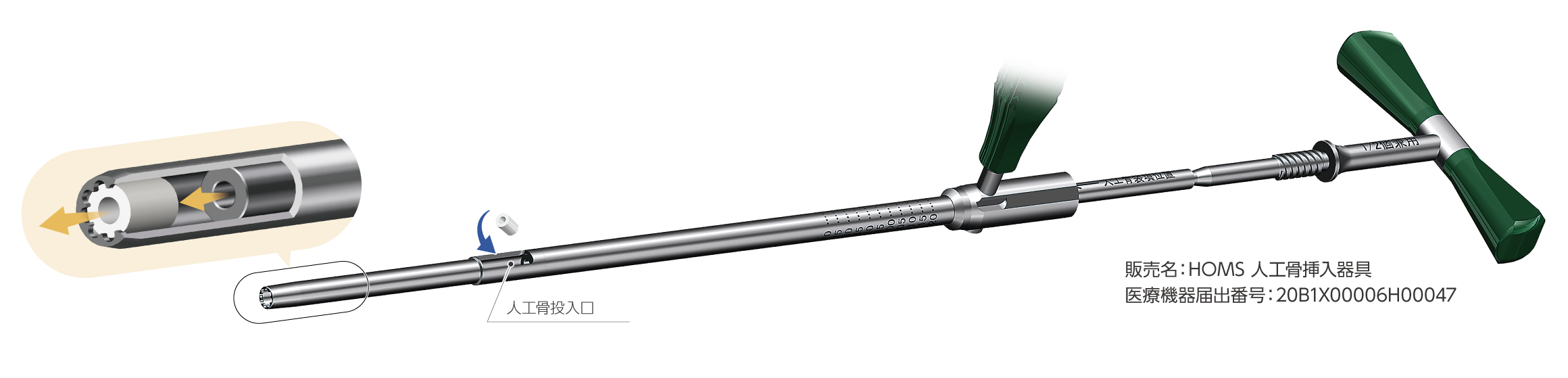 HOMS人工骨破砕挿入器